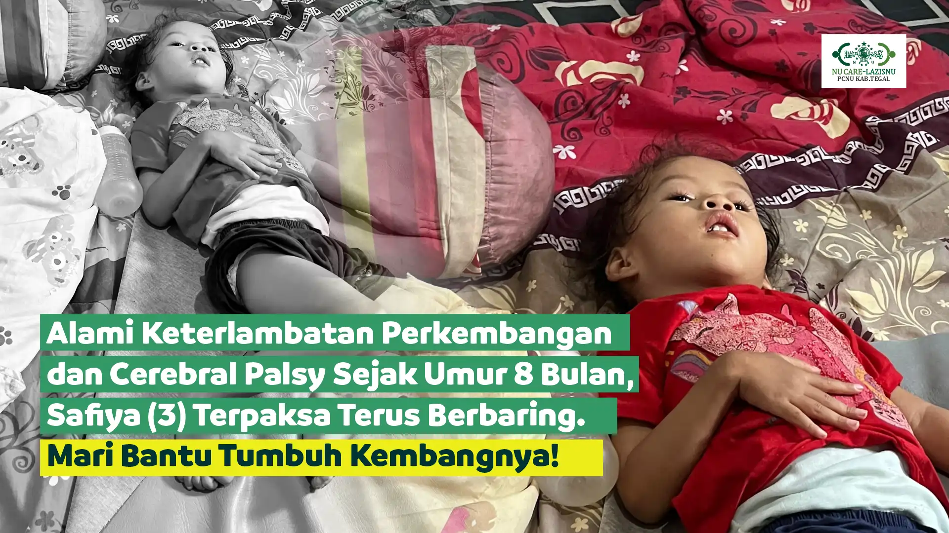 Bantu Safiya (3) Sembuh dari Cerebral Palsy!