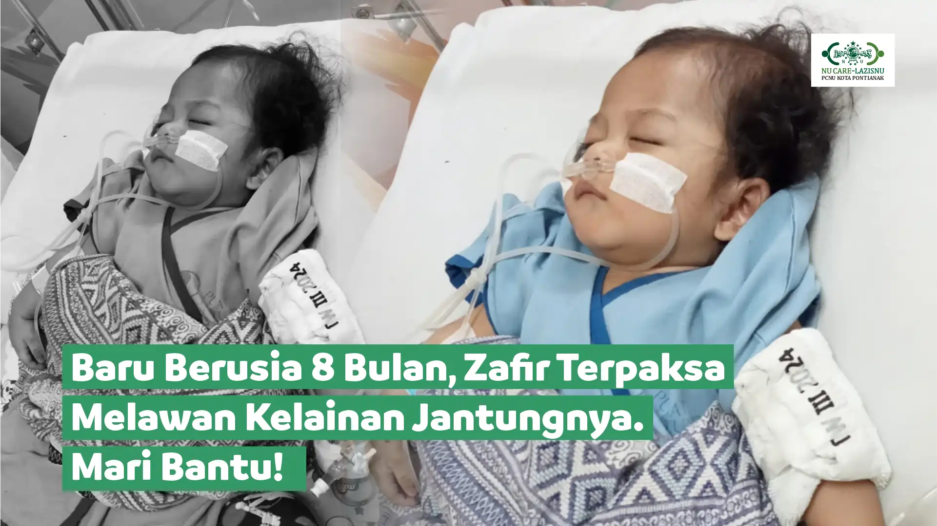 Bantu Zafir (8 bulan) Operasi Kelainan Jantung!
